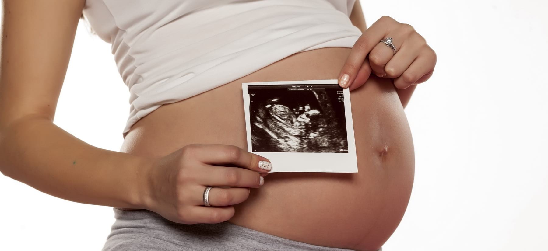 Раз была беременна. УЗИ 3 триместр беременности. 3 Триместр фото на белом фоне.